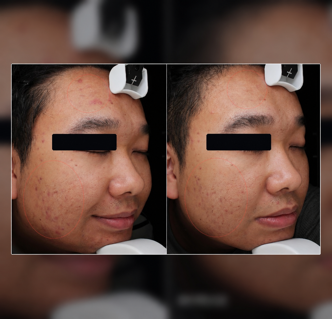 Masked complexion comparison